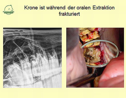 pferd zahnextraktionen10